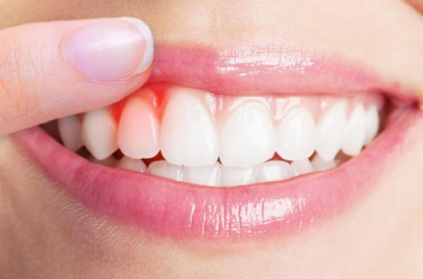 1661515014283579.png 1661515014283579.png